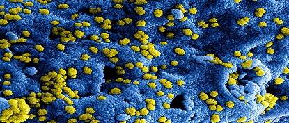 coronavirus